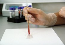 Anticorpos COVID-19 em pacientes recuperados caem rapidamente